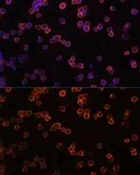 Anti-CD39 antibody used in Immunocytochemistry/ Immunofluorescence (ICC/IF). GTX57161