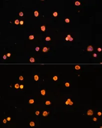 Anti-CD39 antibody used in Immunocytochemistry/ Immunofluorescence (ICC/IF). GTX57161