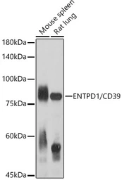 Anti-CD39 antibody used in Western Blot (WB). GTX57161