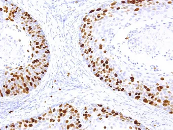 Anti-Ki67 antibody [IHC067] used in IHC (Paraffin sections) (IHC-P). GTX57186