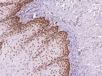 Anti-MLH1 antibody [IHC409] used in IHC (Paraffin sections) (IHC-P). GTX57187