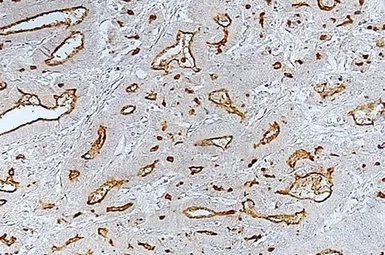 Anti-MUC1 antibody [014E] used in IHC (Paraffin sections) (IHC-P). GTX57210