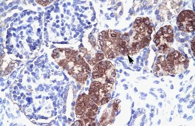Anti-SOX18 antibody used in IHC (Paraffin sections) (IHC-P). GTX57216