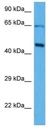 Anti-SOX18 antibody used in Western Blot (WB). GTX57216