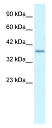 Anti-SOX18 antibody used in Western Blot (WB). GTX57216