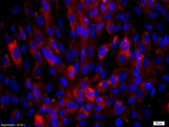 Anti-Biglycan antibody used in Immunocytochemistry/ Immunofluorescence (ICC/IF). GTX57229