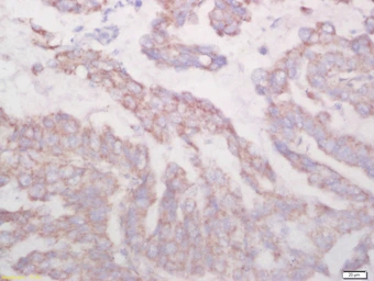Anti-Biglycan antibody used in IHC (Paraffin sections) (IHC-P). GTX57229