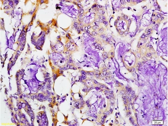Anti-MMP7 antibody used in IHC (Paraffin sections) (IHC-P). GTX57231