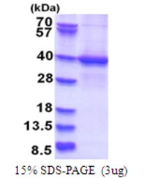 Human LYK5 protein, His tag. GTX57273-pro