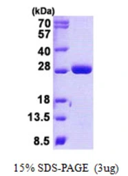 Human MOB1B protein, His tag. GTX57276-pro