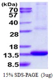 Human ARL9 protein, His tag. GTX57334-pro