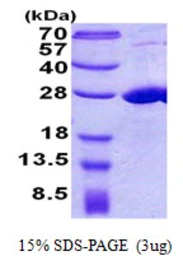 Human COMMD7 protein, His tag. GTX57362-pro