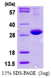 Human DNAJB8 protein, His tag. GTX57374-pro