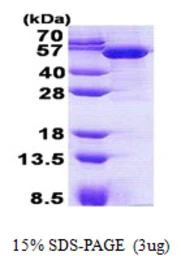 Human TBCEL protein, His tag. GTX57387-pro