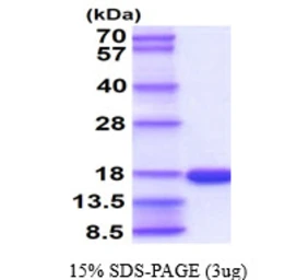 Human T-FABP protein, His tag. GTX57447-pro