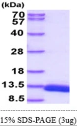 Mouse DBI protein, His tag. GTX57517-pro