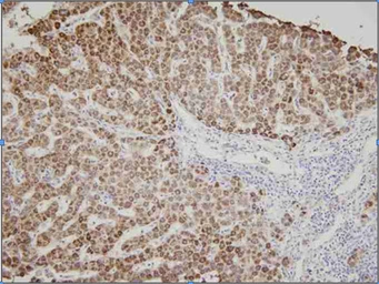 Anti-AK3 antibody [SJB3-36] used in IHC (Paraffin sections) (IHC-P). GTX57541