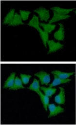 Anti-alpha B Crystallin antibody [2E8] used in Immunocytochemistry/ Immunofluorescence (ICC/IF). GTX57544
