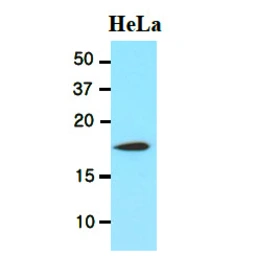 Anti-Cofilin 1 antibody [AT1C1] used in Western Blot (WB). GTX57545