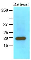 Anti-Myosin Light Chain 2 (MLC-2v) antibody [AT3B2] used in Western Blot (WB). GTX57570