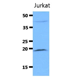 Anti-Diablo antibody [AT19F2] used in Western Blot (WB). GTX57593