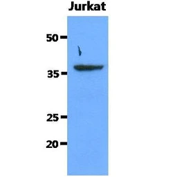 Anti-SORD antibody [AT10F4] used in Western Blot (WB). GTX57595