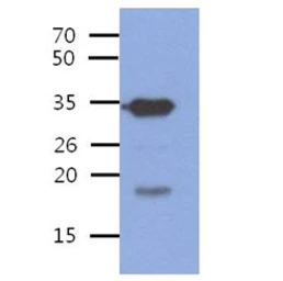 Anti-PDCL3 antibody [AT8F9] used in Western Blot (WB). GTX57608