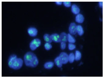 Anti-Nucleophosmin antibody [AT23F1] used in Immunocytochemistry/ Immunofluorescence (ICC/IF). GTX57613