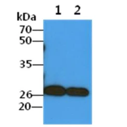 Anti-COMMD7 antibody [AT49B5] used in Western Blot (WB). GTX57616