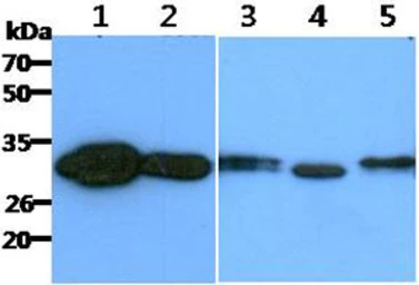 Anti-CBR1 antibody [AT2D6] used in Western Blot (WB). GTX57624