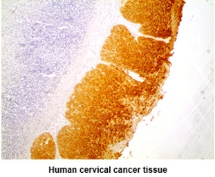 Anti-Cytokeratin 5 antibody [AT12C4] used in IHC (Paraffin sections) (IHC-P). GTX57627