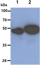 Anti-Cytokeratin 5 antibody [AT12C4] used in Western Blot (WB). GTX57627