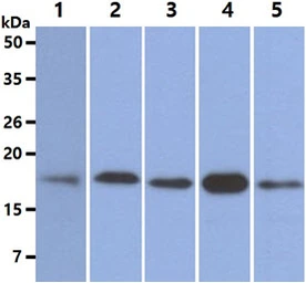 Anti-MTH1 antibody [AT3B3] used in Western Blot (WB). GTX57631