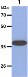 Anti-ARG2 antibody [AT7F8] used in Western Blot (WB). GTX57645
