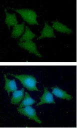 Anti-Cystatin A antibody [AT1B12] used in Immunocytochemistry/ Immunofluorescence (ICC/IF). GTX57681