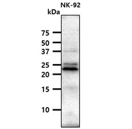 Anti-CD94 antibody [AT13E3] used in Western Blot (WB). GTX57720