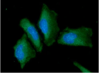 Anti-Alpha fetoprotein / AFP antibody [AT73E10] used in Immunocytochemistry/ Immunofluorescence (ICC/IF). GTX57721