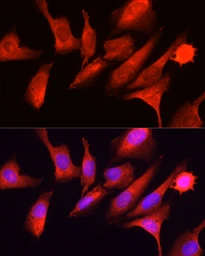 Anti-GCN2 antibody used in Immunocytochemistry/ Immunofluorescence (ICC/IF). GTX57741