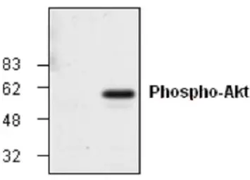 Anti-AKT (phospho Ser473) antibody used in Western Blot (WB). GTX59559