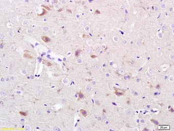 Anti-CACNA1G antibody used in IHC (Paraffin sections) (IHC-P). GTX60133