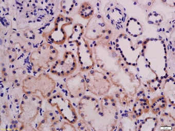 Anti-ABI3 antibody used in IHC (Paraffin sections) (IHC-P). GTX60228