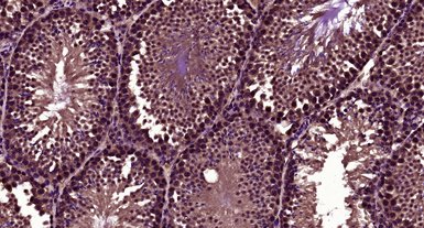 Anti-LBX1 antibody used in IHC (Paraffin sections) (IHC-P). GTX60263