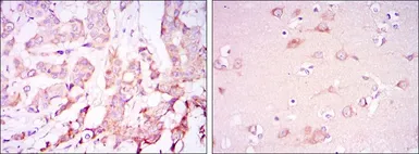 Anti-Pyruvate dehydrogenase kinase 1 / PDK1 antibody [4A11] used in IHC (Paraffin sections) (IHC-P). GTX60386