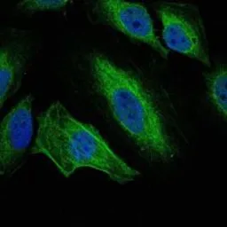 Anti-Aurora A antibody [1F8] used in Immunocytochemistry/ Immunofluorescence (ICC/IF). GTX60391