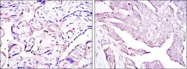 Anti-Human Papillomavirus type 16 E7 antibody [6F3] used in IHC (Paraffin sections) (IHC-P). GTX60410