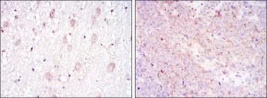 Anti-CD1a antibody [7A7] used in IHC (Paraffin sections) (IHC-P). GTX60418