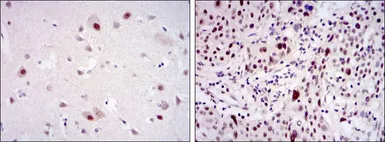 Anti-CDK9 antibody [1B5A7] used in IHC (Paraffin sections) (IHC-P). GTX60442