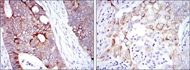 Anti-Cytokeratin 19 antibody [1H6] used in IHC (Paraffin sections) (IHC-P). GTX60457