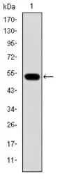 Anti-Glucokinase antibody [4G6] used in Western Blot (WB). GTX60474