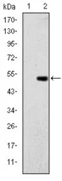 Anti-Glucokinase antibody [4G6] used in Western Blot (WB). GTX60474